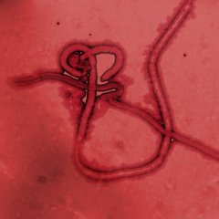 Scary Facts About the World's Deadliest Diseases
