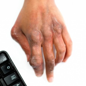 The 15 Most Common Video Game Injuries