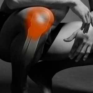 6 Ways To Help Aching Joints