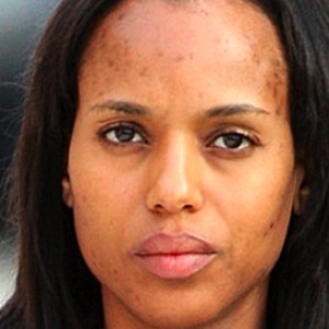 13 Celebrities With Bad Skin Problems That Will Surprise You