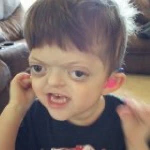 Mom Responds to Cruel Meme About Her Son