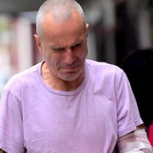 Daniel Day-Lewis Looks Rough After Motorbike Accident