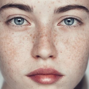 10 Truths You Probably Didn't Know About Freckles
