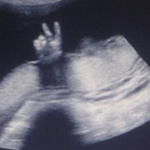 Funny & Amazing Ultrasound Photos