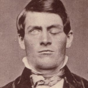 How Phineas Gage's Freak Accident Changed Science Forever