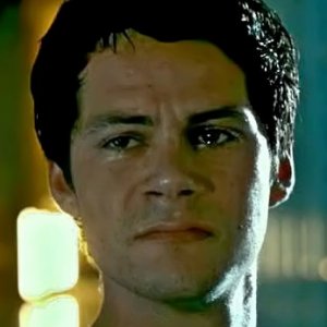 Actors Who Permanently Damaged Their Bodies For A Role