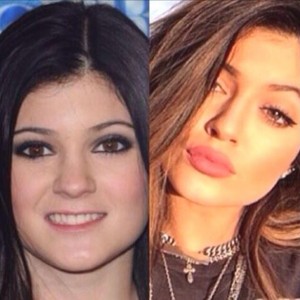 Kylie Jenner's Transformation Through the Years