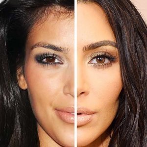 Kim Kardashians Complicated Relationship With Lasers - ZergNet