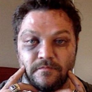 what happened to bam margera