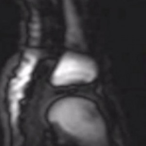 MRI Of A Knuckle Cracking Might Get You To Quit The Habit