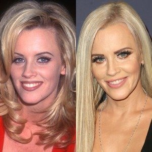 Here's The Deal With Jenny McCarthy's Plastic Surgery - ZergNet