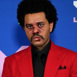 The Real Reason The Weeknd's Face Was Bloody at the VMAs