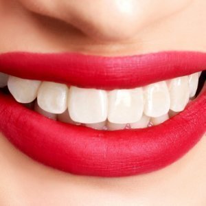 Surprising Foods That Naturally Brighten Your Smile
