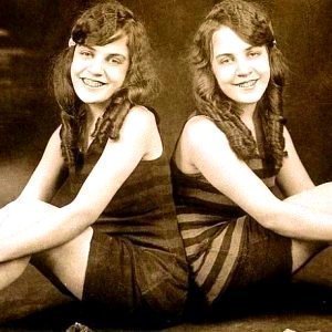 The Astonishing Truth About the Conjoined Hilton Sisters - ZergNet