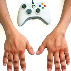 10 Video Game Injuries To Look Out For