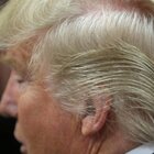 Donald Trump's Bizarre Hairdo Finally Explained