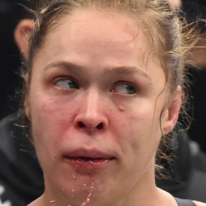 Ronda Rousey Needed Lip Surgery After Upset Loss at UFC 193 - ZergNet