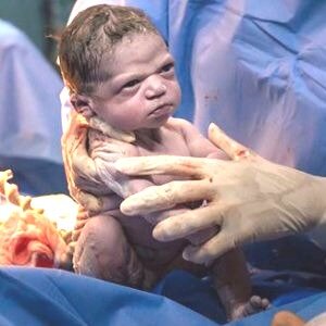 The Brazilian Baby That Became An Internet Sensation