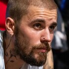 Justin Bieber Suffers Brutal Fall From Electric Skateboard