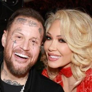 Bunnie Xo Unveils The Gruesome Aftermath Of Her Facelift