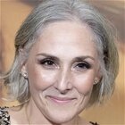 These Stars Prove Thinning Hair Doesn't Just Affect Men