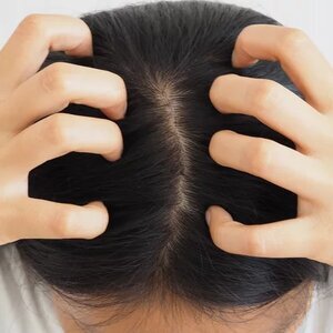 The Facts About Head Lice Nobody Wants To Learn The Hard Way
