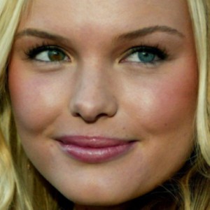 10 Celebs Who Were Born With Deformities